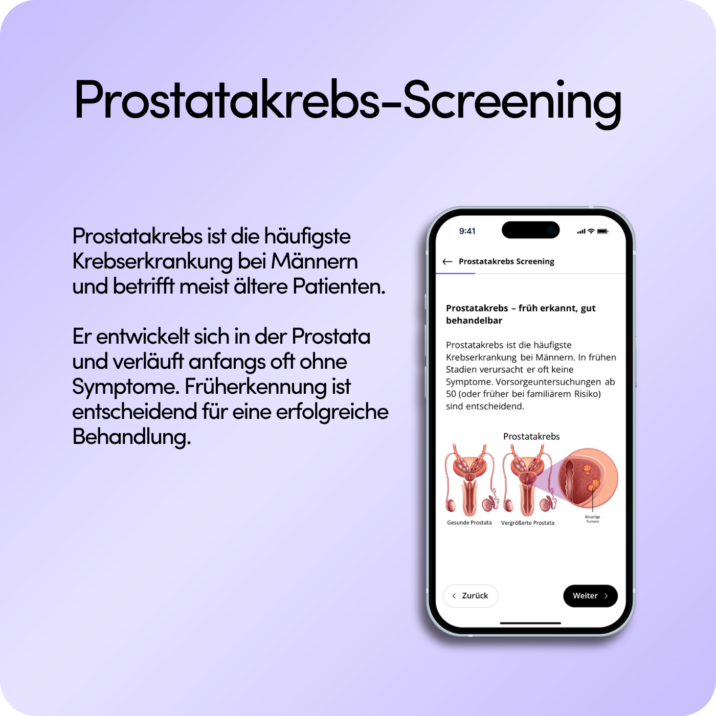 Prostatakrebs-Screening