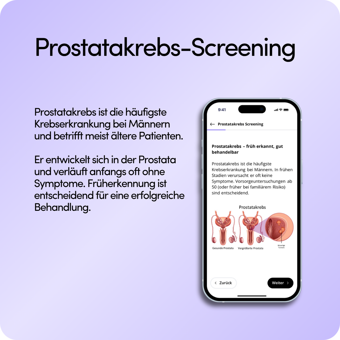 Prostatakrebs-Screening